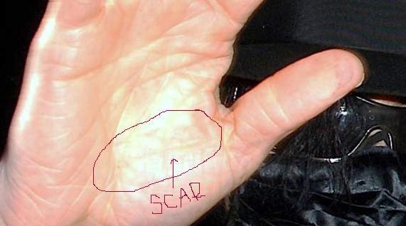 scar10.jpg